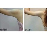 专业调配强效瘦胳膊瘦手臂精油消除蝴蝶臂肌肉臂脂肪臂粗胳膊变细