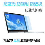 炫龙 炎魔T1 t1 15.6寸笔记本电脑屏幕保护贴膜 高清 磨砂 防蓝光