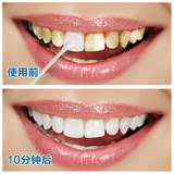 豫冠2016牙斑净白白牙素速效漂白洁白通用10mL牙齿美白脱色剂