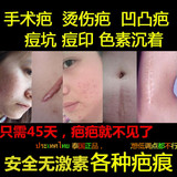 泰国疤痕修复膏10g祛去凹凸手术伤疤刀疤剖腹产烫烧伤疤痘印儿童