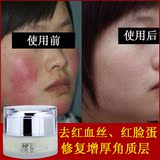 去除红血丝修复增厚角质层薄特效祛红脸蛋皮肤舒缓抗敏感正品面霜