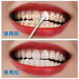 洗牙粉液去黄牙烟渍牙渍去牙结石洁牙白牙素速效神器牙贴牙齿美白