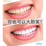 牙贴美白牙齿速效快速清新洁白口腔去黄牙黑牙烟渍牙斑牙除口臭