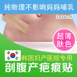 韩国进口可丽尼薄疤痕贴凹凸剖腹产手术修复淡化增生硅胶
